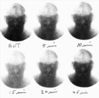 Notdead_delay.jpg (11892 bytes)