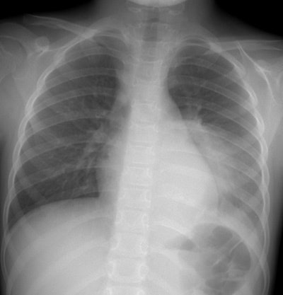 PA small.JPG (36437 bytes)