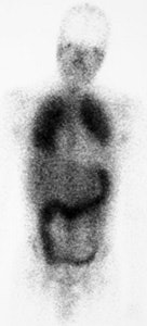 PCP image1.JPG (14409 bytes)