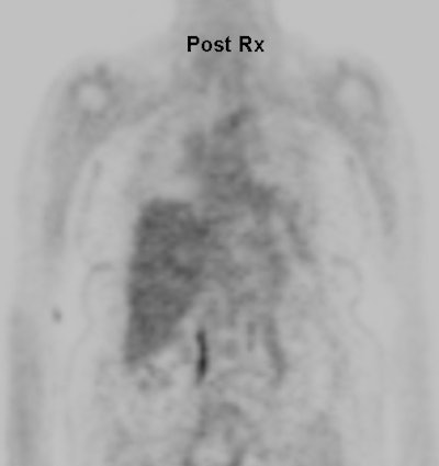 Pet Cholangio Post Rx