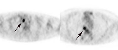 Pet Axial Node