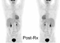 Post-Rx.JPG (8203 bytes)