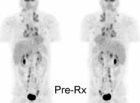 Pre-Rx.JPG (8435 bytes)