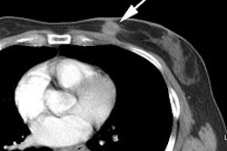 Primary Ct