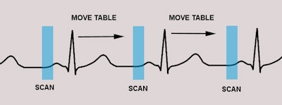 Cardiac > Adultdz > CACalc | AuntMinnie