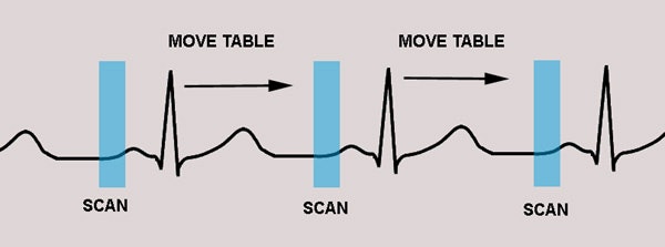 Cardiac > Adultdz > CACalc | AuntMinnie Cardiac > Adultdz > CACalc | AuntMinnie