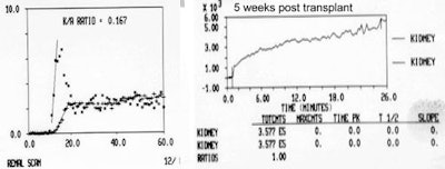 Reject_curves.JPG (22125 bytes)
