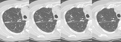 Serial CT.JPG (92568 bytes)