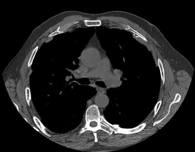 Soft tissue small.JPG (55508 bytes)