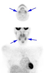 Submandibular