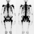 Superscan_prostate.JPG (18042 bytes)