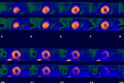 Trans Dilatation A