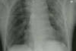 Aorta1a