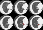 M Ct
