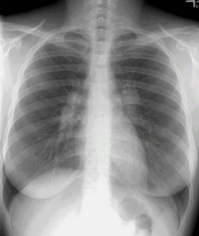Pasarc1