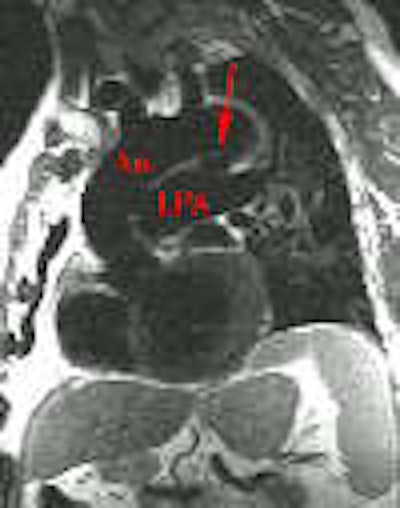 Pda 1a