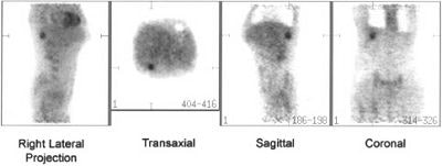 2002 05 06 11 04 56 706