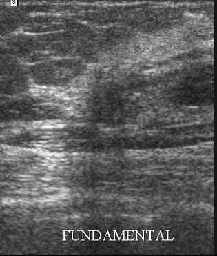 2002 05 09 14 10 27 706