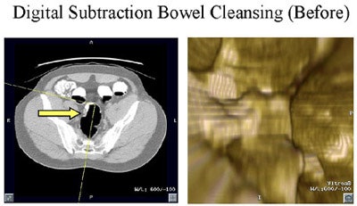 2002 05 31 14 43 00 706