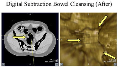 2002 05 31 14 43 34 706