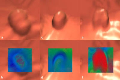 2002 05 31 14 50 00 706