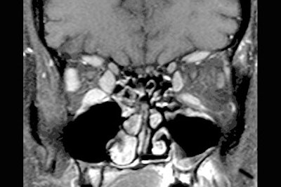 2002 06 07 14 49 42 706