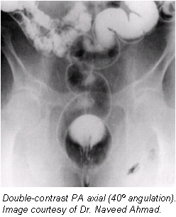 Patient positioning techniques for a lower gastrointestinal series ...