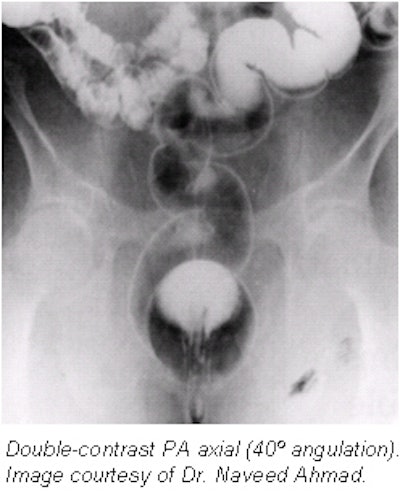 2002 06 26 16 03 55 706