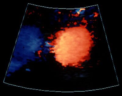 2002 07 01 14 34 01 706