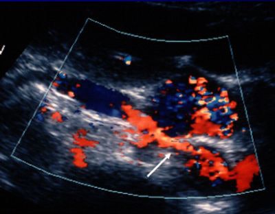 2002 07 01 14 34 29 706