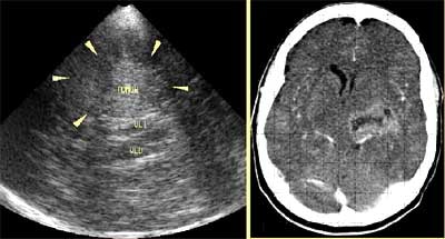 2002 07 03 17 35 00 706