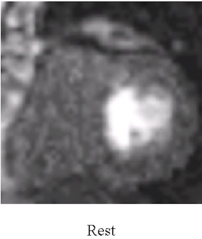 2002 07 17 16 40 01 706