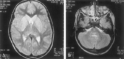 2002 07 18 11 25 45 706