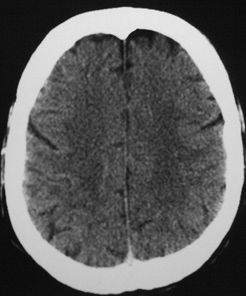 2002 08 13 15 44 55 706