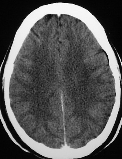 2002 08 13 15 47 07 706