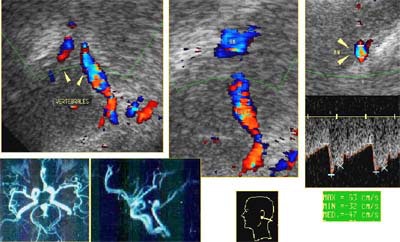 2002 07 03 16 43 07 706