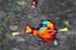 2002 07 03 17 11 13 706