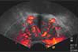 2002 07 04 22 57 15 706