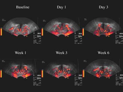 2002 07 04 23 04 53 706