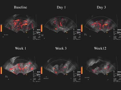 2002 07 04 23 06 13 706