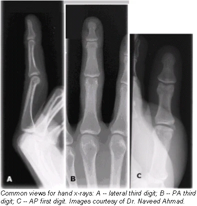 Digit Imaging Digit imaging requires diligent positioning | AuntMinnie