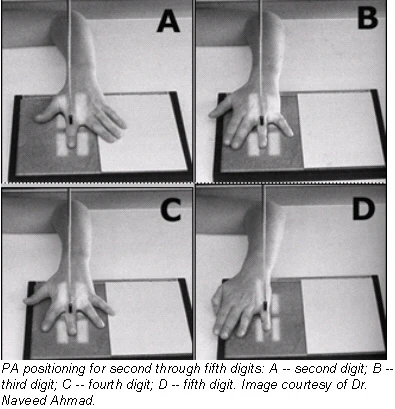 Digit Imaging Digit imaging requires diligent positioning | AuntMinnie