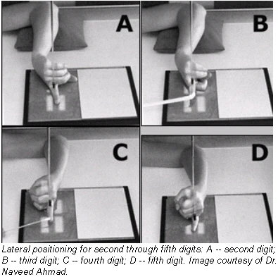 Digit Imaging Digit imaging requires diligent positioning | AuntMinnie