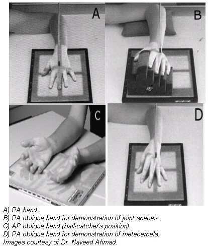 The twists and turns of hand and wrist x-ray positioning | AuntMinnie