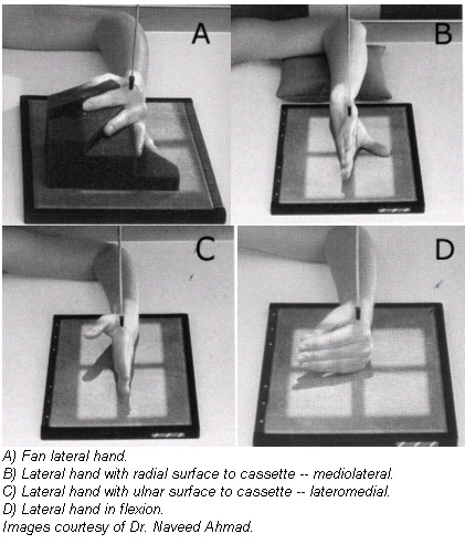 The twists and turns of hand and wrist x-ray positioning | AuntMinnie