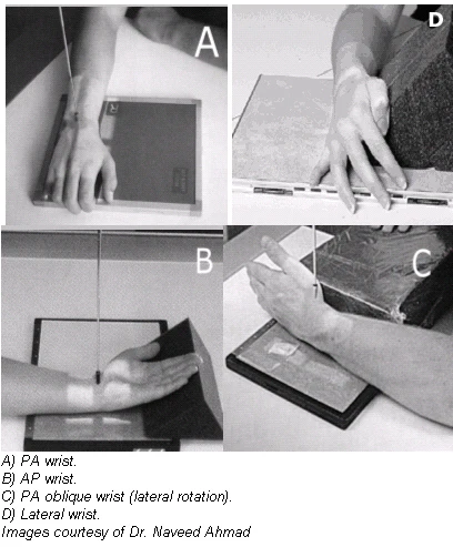 The twists and turns of hand and wrist x-ray positioning | AuntMinnie