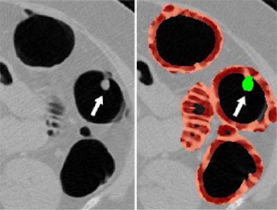 2002 11 05 17 46 09 706