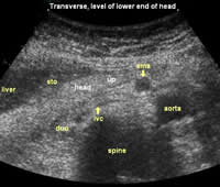Ultrasound of the pancreas: what normal looks like | AuntMinnie