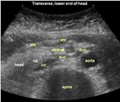 2002 12 13 15 52 58 706