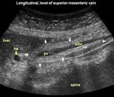 2002 12 16 13 35 12 706